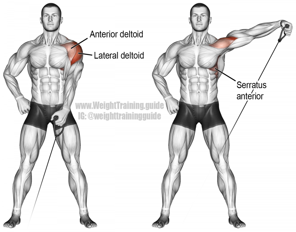 Cable Side Lateral