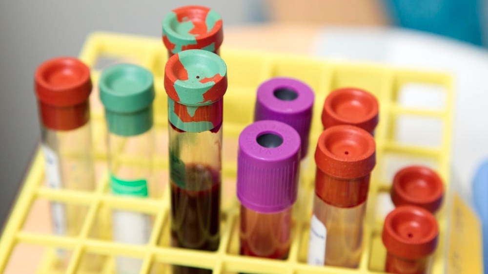 Vegan Blood Test Tips – Blood Tests Every Vegan Should Get In 2022